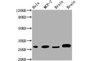 Western Blot Positive WB detected in: Hela whole cell lysate, MCF-7 whole cell lysate, Mouse Brain whole cell lysate, Rat Brain whole cell lysate All lanes: GRB2 antibody at 1:1000 Secondary Goat polyclonal to rabbit IgG at 1/50000 dilution Predicted band size: 26, 21 kDa Observed band size: 28 kDa (Recombinant GRB2 anticorps)