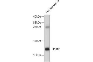 Western blot analysis of extracts of human serum, using PPBP antibody  at 1:1000 dilution. (CXCL7 anticorps  (AA 31-128))