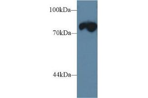 Western blot analysis of Mouse Skeletal muscle lysate, using Rat TRDN Antibody (1 µg/ml) and HRP-conjugated Goat Anti-Rabbit antibody ( (Triadin anticorps  (AA 486-687))