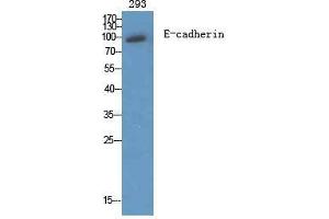 Western Blot (WB) analysis of specific cells using E-cadherin Polyclonal Antibody.