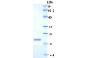 SDS-PAGE analysis of Rat Transferrin Receptor Protein. (Transferrin Receptor Protéine)