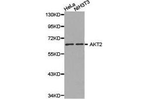 Western Blotting (WB) image for anti-V-Akt Murine Thymoma Viral Oncogene Homolog 2 (AKT2) antibody (ABIN1870912) (AKT2 anticorps)
