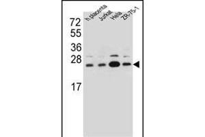 SSR2 Antibody (C-term) (ABIN657094 and ABIN2846252) western blot analysis in human placenta tissue and Jurkat,Hela,ZR-75-1 cell line lysates (35 μg/lane). (SSR2 anticorps  (C-Term))