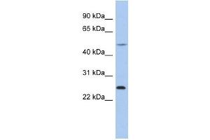 Chymotrypsinogen B1 antibody used at 1 ug/ml to detect target protein. (CTRB1 anticorps  (N-Term))