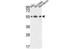 ATP5A1 Antibody (C-term) western blot analysis in WiDr,NCI-H460,MDA-MB231 cell line lysates (35µg/lane). (MT-ATP6 anticorps  (C-Term, Subunit alpha))