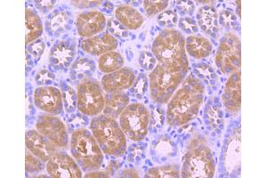 Paraformaldehyde-fixed, paraffin embedded human kidney, Antigen retrieval by boiling in sodium citrate buffer (pH6) for 15min, Block endogenous peroxidase by 3% hydrogen peroxide for 30 minutes, Blocking buffer at 37°C for 20min, Antibody incubation with TrkB (Tyr817) (2A1 ) Monoclonal Antibody  at 1:50 overnight at 4°C, followed by a conjugated secondary and DAB staining.