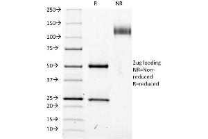 SDS-PAGE Analysis Purified CD25 Mouse Monoclonal Antibody (IL2RA/423). (CD25 anticorps)