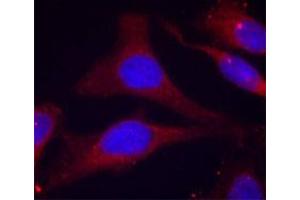 Immunofluorescence staining of methanol-fixed HeLa cells using PTPN6 (phospho Y536) polyclonal antibody .
