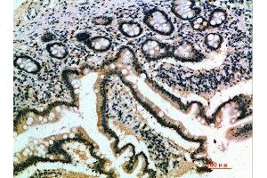 Immunohistochemical analysis of paraffin-embedded human-small-intestine, antibody was diluted at 1:200 (IL17B anticorps  (AA 1-50))