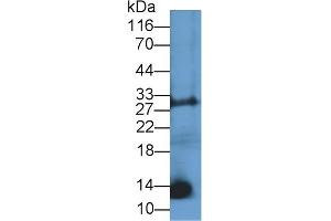Detection of CNP in Mouse Liver lysate using Polyclonal Antibody to C-Type Natriuretic Peptide (CNP)