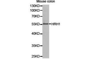 Western Blotting (WB) image for anti-Histamine Receptor H1 (HRH1) antibody (ABIN1873083) (HRH1 anticorps)