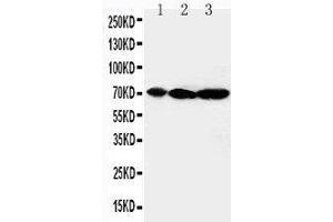 Anti-MEKK2 antibody, Western blotting Lane 1: Rat Brain Tissue Lysate Lane 2: Rat Testis Tissue Lysate Lane 3: Rat Lung Tissue Lysate (MAP3K2 anticorps  (C-Term))