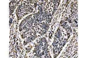 IHC analysis of SnoN/SNO/SKIL using anti-SnoN/SNO/SKIL antibody (ABIN7599455). (SKIL anticorps  (AA 1-504))