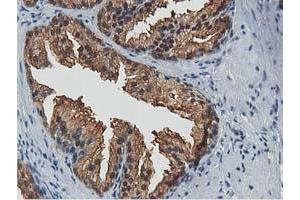 Image no. 1 for anti-Acetyl-CoA Acetyltransferase 2 (ACAT2) antibody (ABIN1496396)