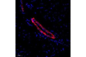 Immunofluorescence analysis of paraffin embedded rat skeletal muscle using ACTN1 (ABIN7072905) at dilution of 1: 500