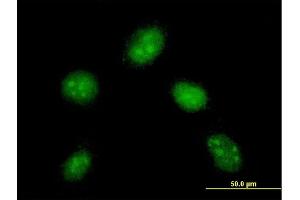 Immunofluorescence of monoclonal antibody to DYDC1 on HeLa cell. (DYDC1 anticorps  (AA 1-177))