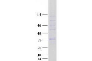 Validation with Western Blot