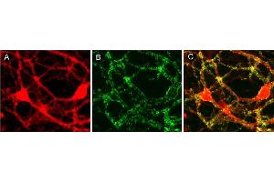 Immunocytochemistry (ICC) image for anti-Liprin alpha 3 (PPFIA3) (AA 463-604) antibody (ABIN1742356)