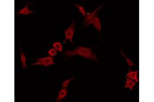 ABIN6274406 staining 293 by IF/ICC. (ARMCX2 anticorps  (Internal Region))