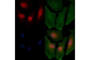 ABIN6264196 and ABIN6266654 staining  cells by IF/ICC. (PIAS2 anticorps  (N-Term))