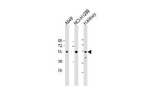Western Blot at 1:2000 dilution Lane 1: A549 whole cell lysate Lane 2: NCI-H1299 whole cell lysate Lane 3: human kidney lysate Lysates/proteins at 20 ug per lane. (GCNT3 anticorps  (N-Term))