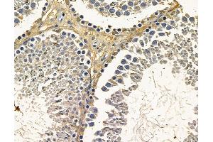 ABIN7096796 and ABIN7100862 at 1/100 staining rat testis tissue by IHC-P. (DHX37 anticorps)