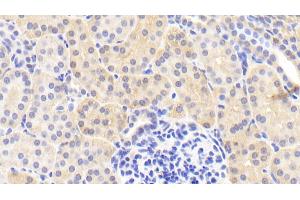 Detection of PRDX6 in Human Kidney Tissue using Polyclonal Antibody to Peroxiredoxin 6 (PRDX6)