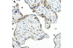 Immunohistochemistry of paraffin-embedded human placenta using PRG2 Rabbit pAb (ABIN3016203, ABIN3016204, ABIN3016205, ABIN1682289 and ABIN6219622) at dilution of 1:100 (40x lens).