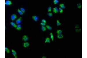 Immunofluorescence staining of Hela cells with ABIN7159477 at 1:50, counter-stained with DAPI. (TRABD2B anticorps  (AA 195-405))