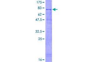 Image no. 1 for Ring Finger Protein 1 (RING1) (AA 1-377) protein (GST tag) (ABIN1318089)