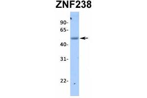 Host:  Rabbit  Target Name:  ZNF238  Sample Type:  Human Fetal Lung  Antibody Dilution:  1.