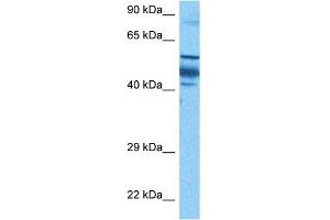 Host:  Rabbit  Target Name:  ZNF519  Sample Tissue:  Human Gallbladder Tumor lysates  Antibody Dilution:  1ug/ml (ZNF519 anticorps  (N-Term))