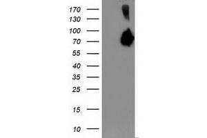 Western Blotting (WB) image for anti-Asparagine Synthetase (ASNS) antibody (ABIN1496750) (Asparagine Synthetase anticorps)
