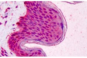 Human Skin: Formalin-Fixed, Paraffin-Embedded (FFPE) (RAD51 anticorps)