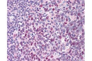 Anti-ERCC3 / XPB antibody IHC of human tonsil.