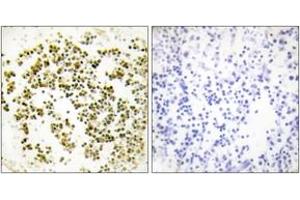 Immunohistochemistry analysis of paraffin-embedded human lymph node tissue, using Musculin Antibody.