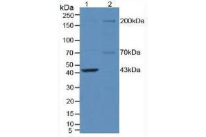 Western blot analysis of (1) Mouse Brain Tissue and (2) Mouse Testis Tissue. (NOS1 anticorps  (AA 1199-1399))