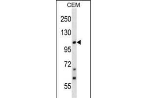 TRPC7 Antibody (C-term) (ABIN1537625 and ABIN2848540) western blot analysis in CEM cell line lysates (35 μg/lane).
