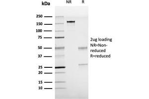 SDS-PAGE Analysis Purified TTF-1 Mouse Recombinant Monoclonal Antibody (rNX2. (Recombinant NKX2-1 anticorps)