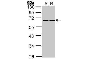WB Image Sample (30 ug of whole cell lysate) A: A431 , B: H1299 10% SDS PAGE antibody diluted at 1:1000