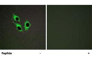 Immunofluorescence analysis of HepG2 cells, using ANO9 polyclonal antibody . (ANO9 anticorps)