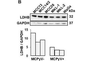 LDHB is inversely correlated with miR-375 in MCC tumors and cell lines.