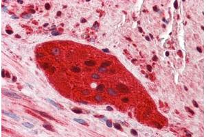 Human Small Intestine, Myenteric Plexus: Formalin-Fixed, Paraffin-Embedded (FFPE)