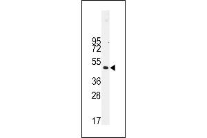 Western blot analysis of anti-Desmin Antibody (t16) (ABIN389226 and ABIN2839379) in NCI- cell line lysates (35 μg/lane). (Desmin anticorps  (AA 1-30))
