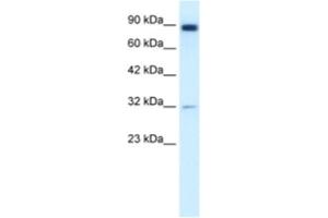 Western Blotting (WB) image for anti-Matrix Metallopeptidase 9 (Gelatinase B, 92kDa Gelatinase, 92kDa Type IV Collagenase) (MMP9) antibody (ABIN2460650) (MMP 9 anticorps)