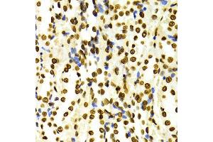 Immunohistochemistry of paraffin-embedded Rat kidney using H3K27me2 antibody at dilution of 1:100 (x400 lens).