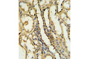 TR Antibody (N-term) 6545a IHC analysis in formalin fixed and paraffin embedded human kidney tissue followed by peroxidase conjugation of the secondary antibody and DAB staining.