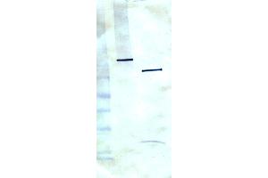 Western blot using anti-PARP1, clone C-2-10. (PARP1 anticorps)