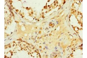 Immunohistochemistry of paraffin-embedded human testis tissue using ABIN7154932 at dilution of 1:100 (HHIP anticorps  (AA 18-220))
