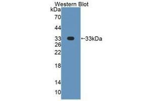 Detection of Recombinant DICER1, Human using Polyclonal Antibody to Dicer 1, Ribonuclease Type III (DICER1) (DICER1 anticorps  (AA 6-290))